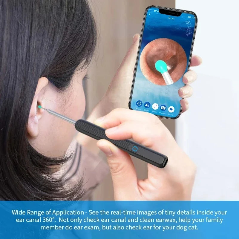 Smart Wireless Ear Cleaner